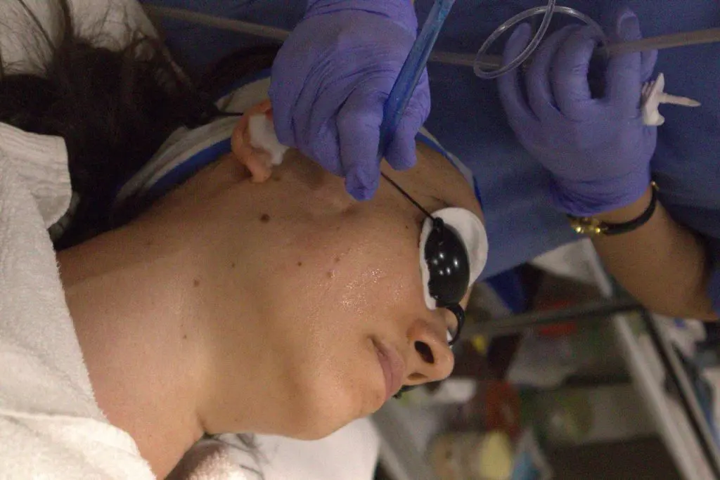 Pre-wedding beauty treatments